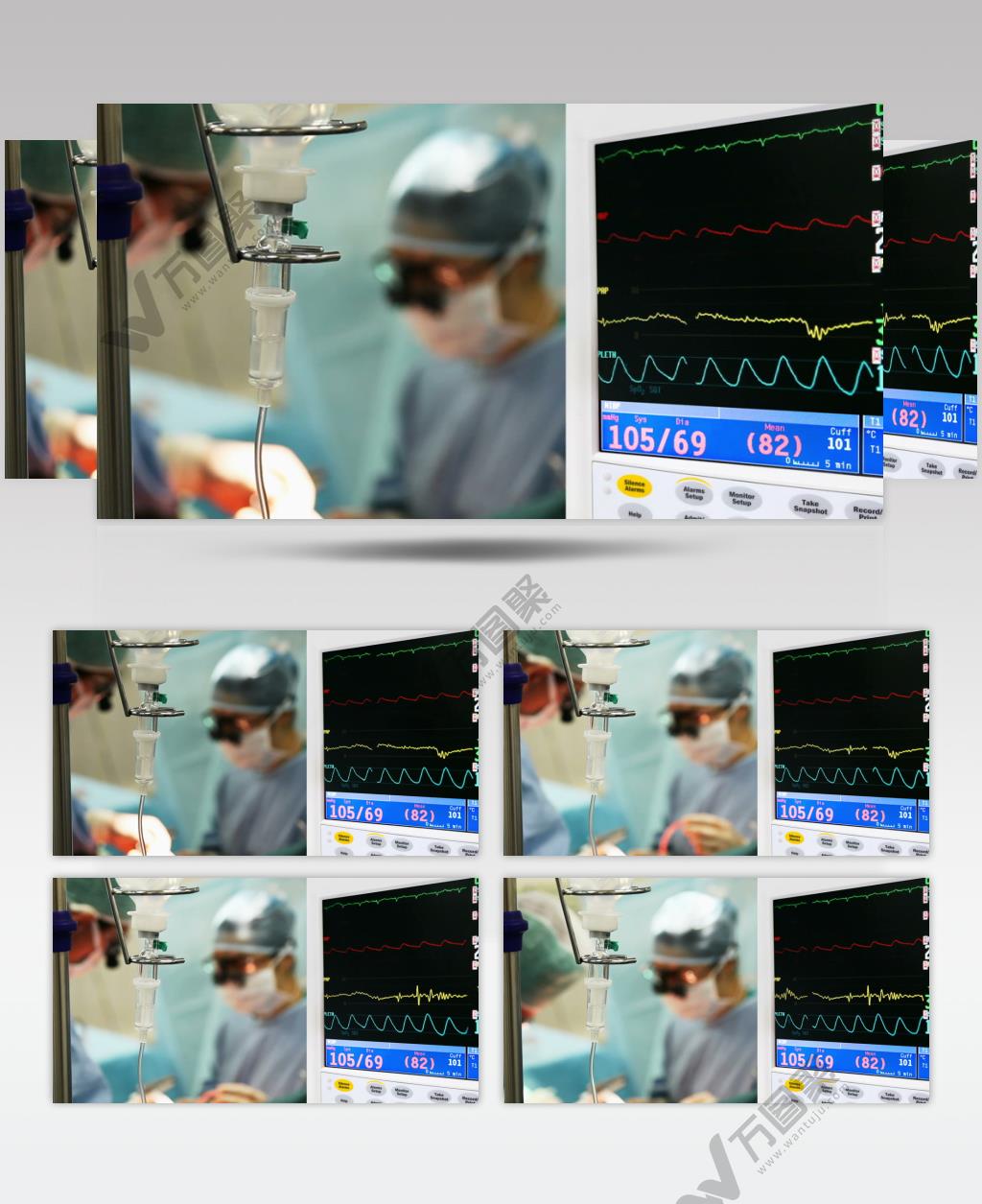 医院ICU重症监护抢救病人显示屏视频素材
