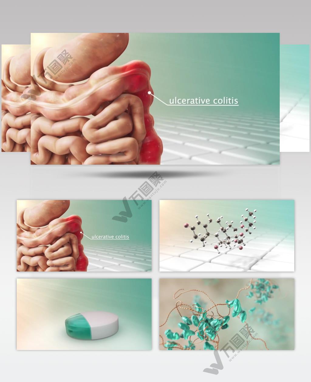 溃疡性结肠炎医疗三维机理动画素材