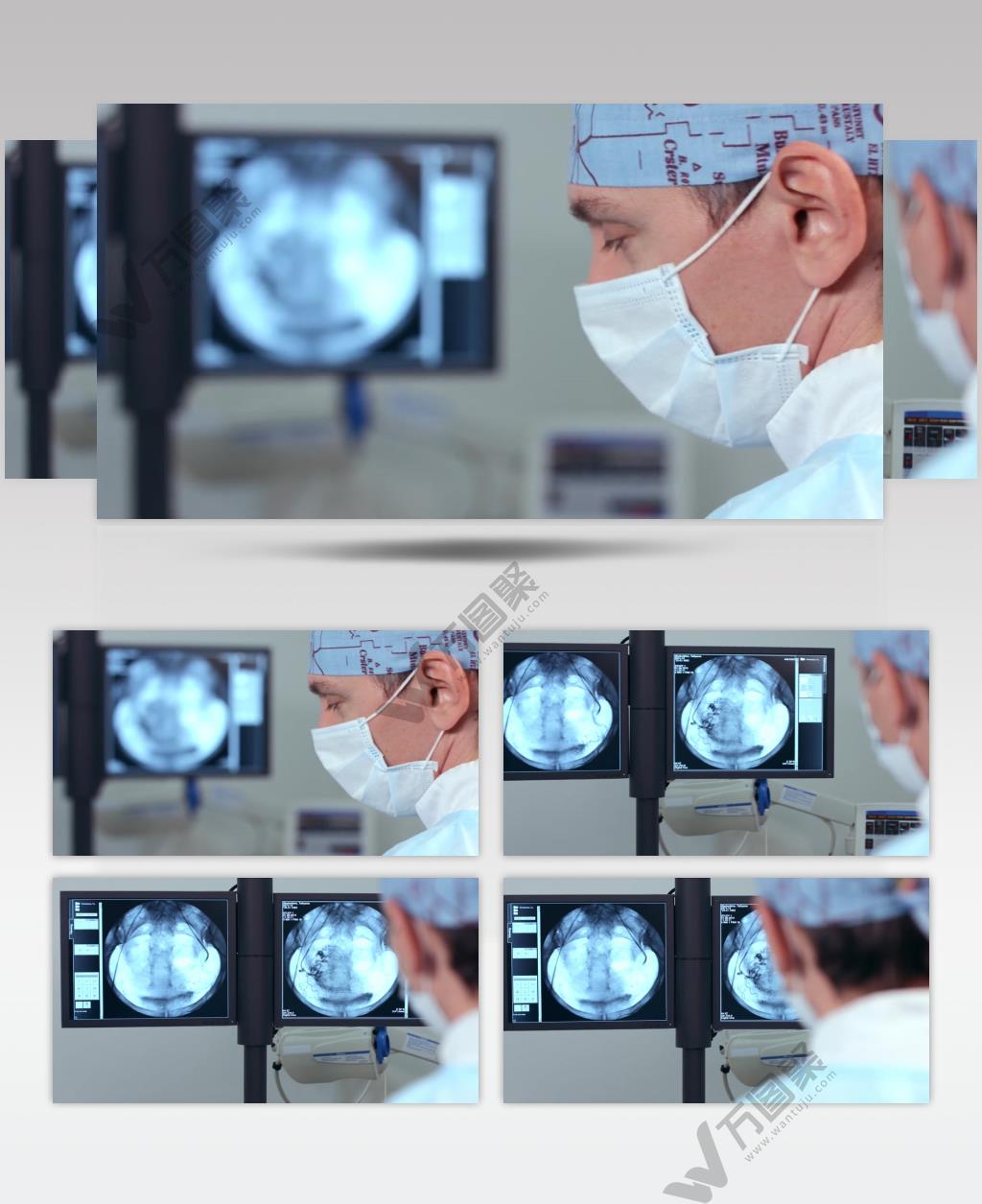 医生观察医学影像视频素材