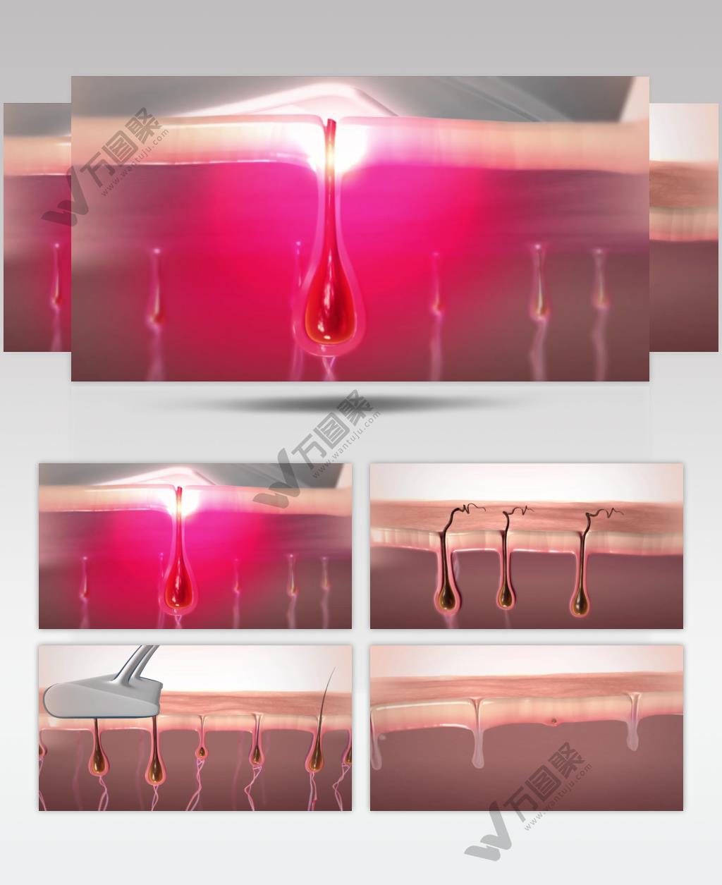 激光美容脱毛三维动画